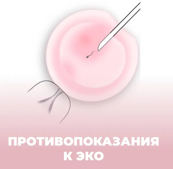 Абсолютные и относительные противопоказания к ЭКО